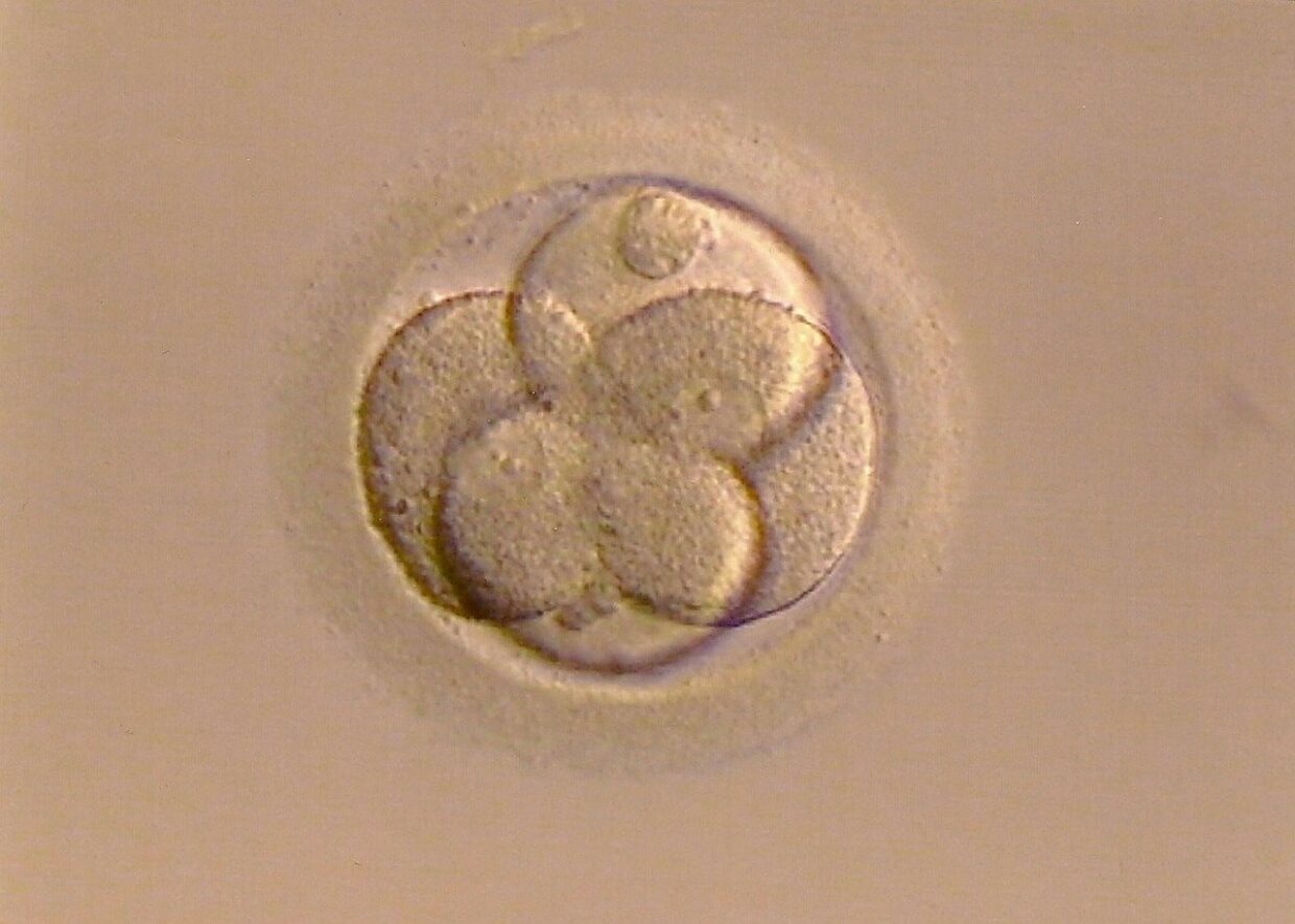 embrión-infertilymadre